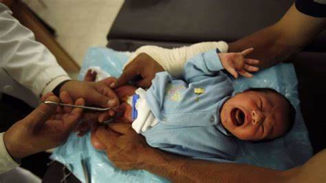 baby's-Circumcision-infant-circumcision-newborn-Circumcision