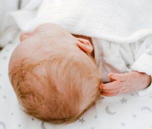newborn baby without soft spot