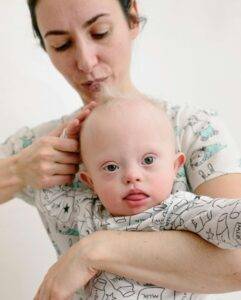 newborn baby hair fall off