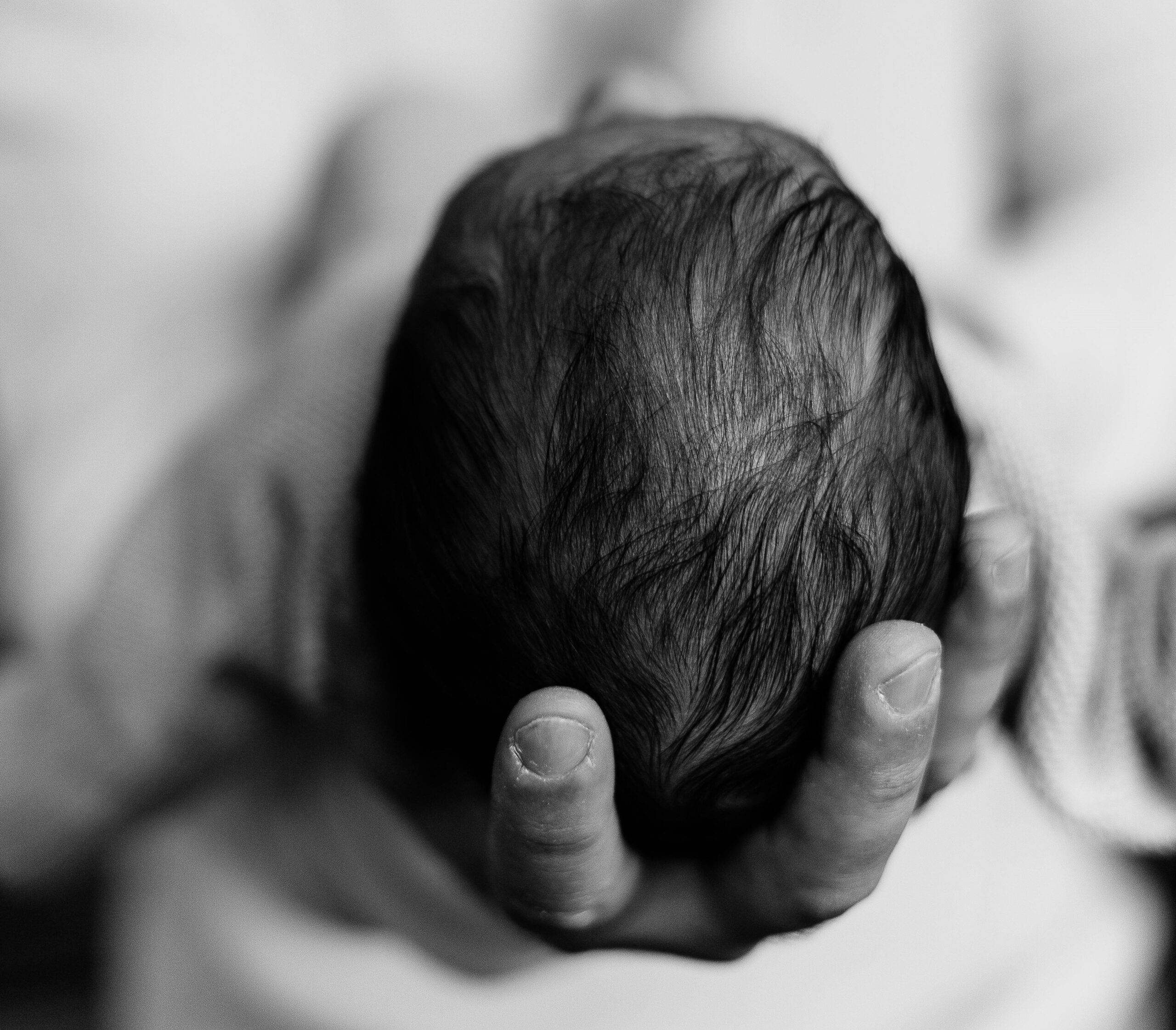 newborn baby hair fall out