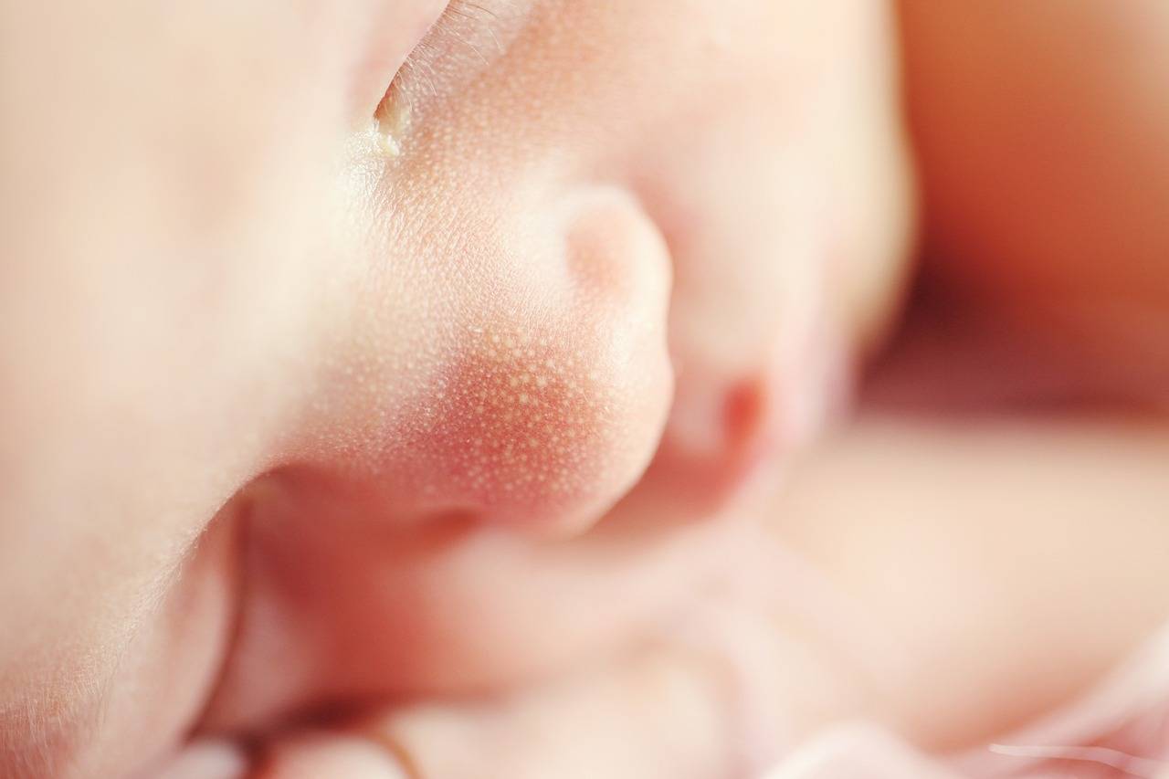 newborn baby heat rash